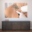 Painel Adesivo de Parede - Remoção de Tatuagem - 1202png