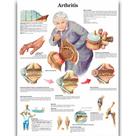 Pano de pintura de artrite de anatomia médica de pôster 40x60cm