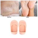 Par Protetor Calcanhar Silicone Macio Anti Bolhas Calos Sapato Nude Original Top Promo
