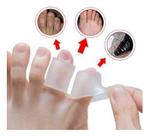 Par Protetor Dedo Silicone Anel Calo Joanete Pés Lesão Dor
