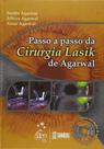 Passo a passo da cirurgia lasik de agarwal - SANTOS Passo a passo da cirurgia lasik de agarwal - SANTOS