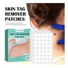 Patch Invisível Verruga Sinal Skin Tag Remover Adesivo Tratamento Rápido 36un Qualidade Top