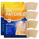 Patches para cuidados com as unhas dos pés IRSRDOQU, kit com 2 unidades, reparação noturna