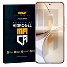 Película Hidrogel Frontal Realme 14 Pro Privacidade Película Hidrogel Frontal Realme 14 Pro Privacidade