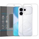 Película Hidrogel HD Frente e Verso Para Oppo Reno 16