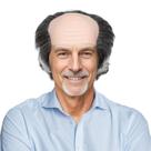 Peruca de cosplay engraçada, careca, com lados de cabelo, 18 cm, sintética