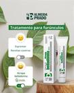 Pomada de Atropa Belladonna 25g - Medicamento Homeopático para Inflamações