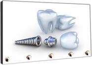 Porta Chave Dentista Dente Consultórios Sorriso Implante Organizador Chaveiros