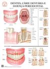 Pôster Educativo dos Dentes Cárie Dentária e Doença Periodontal