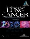 Principles and practice of lung cancer - Lippincott/wolters Kluwer Health