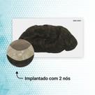 Protese Capilar Hibrida Dm - Micropele + Tela Lace (15X20)