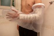 Protetor Impermeável Para Braço Gesso Curativo Banho Tovcare