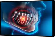 Quadro Decorativo Abstrato Canvas Moldura Filete Odontologia Dentista Dente