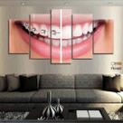 Quadro Decorativo Dentista Aparelho 63x130mt com 5 peças