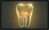 Quadro Decorativo Dentista Dente Dourado Abstrato Odontologia Consultórios Salas Com Moldura RC027 Quadro Decorativo Dentista Dente Dourado Abstrato Odontologia Consultórios Salas Com Moldura RC027