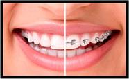 Quadro Decorativo Dentista Dentes Odontologia Consultórios Salas Com Moldura RC007 Quadro Decorativo Dentista Dentes Odontologia Consultórios Salas Com Moldura RC007