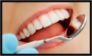 Quadro Decorativo Dentista Dentes Sorriso Odontologia Consultórios Salas Com Moldura RC010
