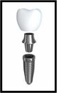 Quadro Decorativo Dentista Implantes Dentes Odontologia Consultórios Salas Com Moldura RC008 Quadro Decorativo Dentista Implantes Dentes Odontologia Consultórios Salas Com Moldura RC008