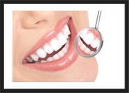 Quadro Decorativo Dentista Odontologia Consultórios Dentes Sorriso Com Moldura