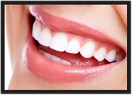 Quadro Decorativo Dentista Odontologia Consultórios Dentes Sorriso Com Moldura