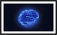 Quadro Decorativo Medicina Médicos Cérebro Neurologia Psiquiatria Consultórios Com Moldura RC030