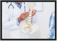 Quadro Decorativo Medicina Médicos Ortopedia Consultórios Decorações Com Moldura