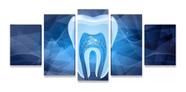 Quadro Mosaico Par Sala 5 Partes Consultorio Dentista Azul