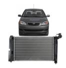 Radiador Corolla 2002 2003 2004 2005 2006 2007 2008 - Manual Radiador Corolla 2002 2003 2004 2005 2006 2007 2008 - Manual