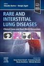Rare and interstitial lung diseases - ELSEVIER (IMPORT) 2024