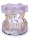 Rd-022 pediatria 7 anos transparente dentição mista c/ germes