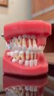 Rd-031 pediatria 5 anos dentição decídua hemi-arco c/ gengiva aberta rosa rígido Rd-031 pediatria 5 anos dentição decídua hemi-arco c/ gengiva aberta rosa rígido
