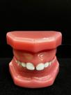 RD-040 Modelo Pediatria dentição mista classe II RD-040 Modelo Pediatria dentição mista classe II