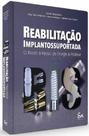 Reabilitação Implantossuportada: O Passo A Passo Da Cirurgia À Prótese - Santos Publicações
