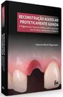 Reconstrução Alveolar Proteticamente Guiada - Santos Publicações Reconstrução Alveolar Proteticamente Guiada - Santos Publicações