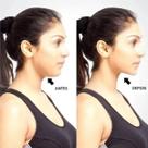 Redutor de Papada e Queixo Duplo Neckline Slimmer Exercitador Facial Profissional 3 Níveis de Mola