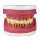 Refil De Cirurgia com Dentes de Periodontia AC 025 Pronew