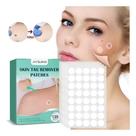 Removedor Verrugas Sinais Skin Tag Remover Adesivos Tratamento 36 Unids Qualidade Original