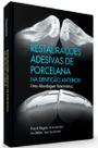 Restaurações adesivas de porcelana na dentição anterior - Santos Publicações