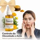 Sabonete de Açafrão Artesanal + Tônico