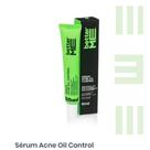 Serum acne oil control