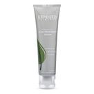 Sérum de tratamento da acne para cuidados com a pele exposta, etapa 3, 100mL