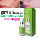 Sérum Efeito Secativo para Espinhas e Acnes