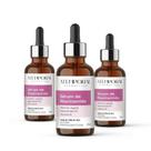 Sérum Niacinamida Antiacne Pele Oleosa Cravos Espinhas Poros 30ml