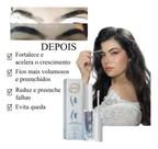 Serum Para Cílios E Sobrancelha Fortalece E Cresce Mais Rápido 5ml