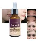 Serum Poderoso Retinol Anti Idade 30ml.
