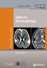 Signos en neurorradiologia (espanhol) - Ediciones Journal Sa Signos en neurorradiologia (espanhol) - Ediciones Journal Sa