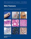 SKIN TUMOURS, Autor: WHO