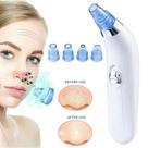 Sugador de Cravos e Espinhas Dermoclean Original Aparelho Vácuo Facial Limpeza de Pele 4 Bicos