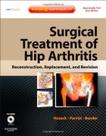 Surgical Treatment Of Hip Arthritis Surgical Treatment Of Hip Arthritis