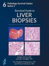 Survival guide to liver biopsies - Innovative Science Press Survival guide to liver biopsies - Innovative Science Press